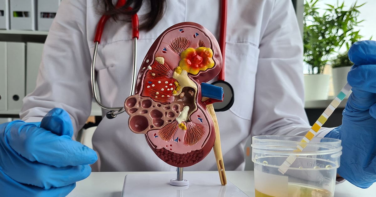 Kidney Function Test | Zam Labs